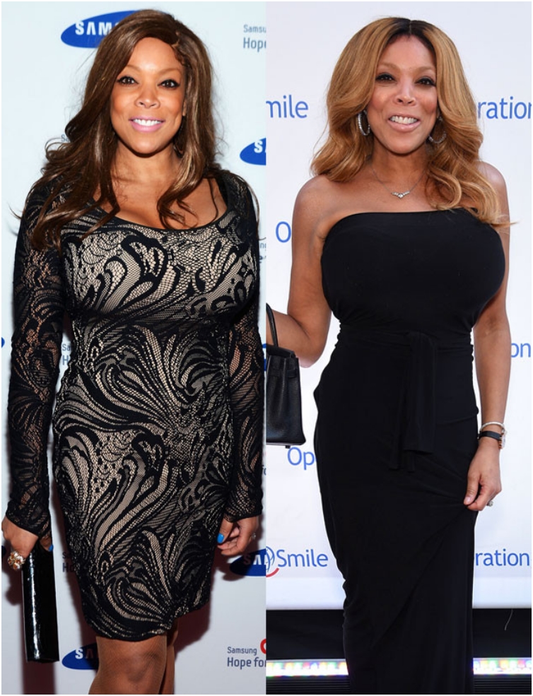 53 Celebs With Massive Weight Loss Transformations