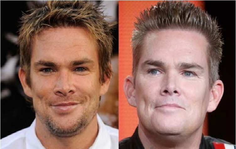Plastic Surgery Guy From Just Go With It 50 Famous Men Who Have Done Plastic Surgery - Ritely